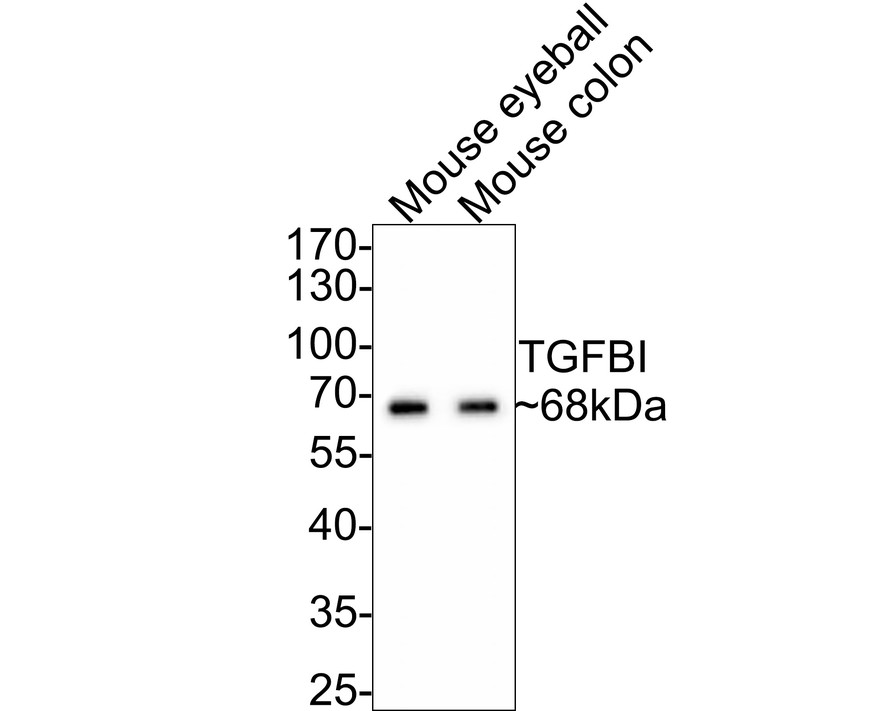 Western blot analysis of TGFBI on different lysates with Rabbit anti-TGFBI antibody (ET1705-29) at 1/500 dilution.<br />
<br />
Lane 1: Mouse eyeball tissue lysate<br />
Lane 2: Mouse colon tissue lysate<br />
<br />
Lysates/proteins at 20 µg/Lane.<br />
<br />
Predicted band size: 75 kDa<br />
Observed band size: 68 kDa<br />
<br />
Exposure time: 2 minutes;<br />
<br />
10% SDS-PAGE gel.<br />
<br />
Proteins were transferred to a PVDF membrane and blocked with 5% NFDM/TBST for 1 hour at room temperature. The primary antibody (ET1705-29) at 1/500 dilution was used in 5% NFDM/TBST at room temperature for 2 hours. Goat Anti-Rabbit IgG - HRP Secondary Antibody (HA1001) at 1:300,000 dilution was used for 1 hour at room temperature.