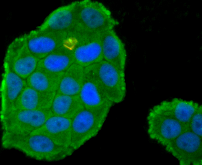 ICC staining of Protein C in Hela cells (green). Formalin fixed cells were permeabilized with 0.1% Triton X-100 in TBS for 10 minutes at room temperature and blocked with 10% negative goat serum for 15 minutes at room temperature. Cells were probed with the primary antibody (ET1705-3, 1/50) for 1 hour at room temperature, washed with PBS. Alexa Fluor®488 conjugate-Goat anti-Rabbit IgG was used as the secondary antibody at 1/1,000 dilution. The nuclear counter stain is DAPI (blue).