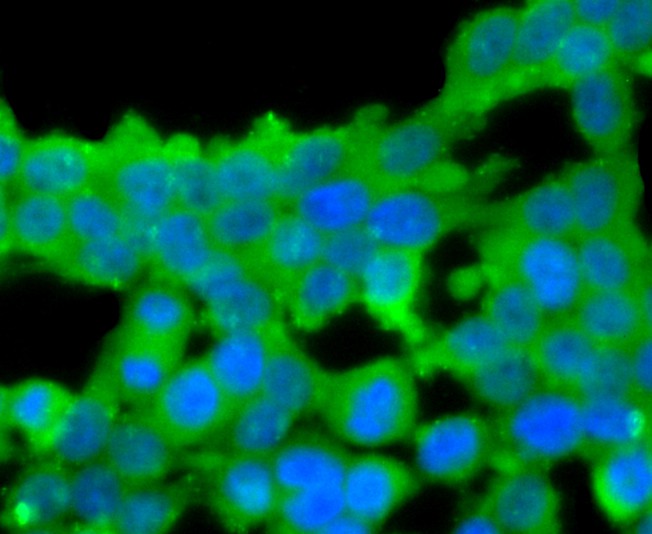 ICC staining of Protein C in 293T cells (green). Formalin fixed cells were permeabilized with 0.1% Triton X-100 in TBS for 10 minutes at room temperature and blocked with 10% negative goat serum for 15 minutes at room temperature. Cells were probed with the primary antibody (ET1705-3, 1/50) for 1 hour at room temperature, washed with PBS. Alexa Fluor®488 conjugate-Goat anti-Rabbit IgG was used as the secondary antibody at 1/1,000 dilution. The nuclear counter stain is DAPI (blue).