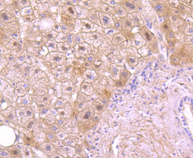 Immunohistochemical analysis of paraffin-embedded human liver tissue using anti-Protein C antibody. The section was pre-treated using heat mediated antigen retrieval with Tris-EDTA buffer (pH 9.0) for 20 minutes.The tissues were blocked in 1% BSA for 30 minutes at room temperature, washed with ddH2O and PBS, and then probed with the primary antibody (ET1705-3, 1/50) for 30 minutes at room temperature. The detection was performed using an HRP conjugated compact polymer system. DAB was used as the chromogen. Tissues were counterstained with hematoxylin and mounted with DPX.