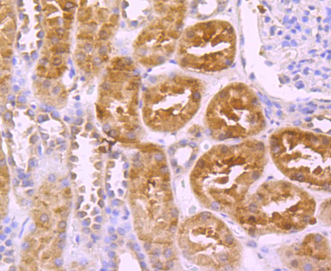 Immunohistochemical analysis of paraffin-embedded human kidney tissue using anti-Protein C antibody. The section was pre-treated using heat mediated antigen retrieval with Tris-EDTA buffer (pH 9.0) for 20 minutes.The tissues were blocked in 1% BSA for 30 minutes at room temperature, washed with ddH2O and PBS, and then probed with the primary antibody (ET1705-3, 1/50) for 30 minutes at room temperature. The detection was performed using an HRP conjugated compact polymer system. DAB was used as the chromogen. Tissues were counterstained with hematoxylin and mounted with DPX.