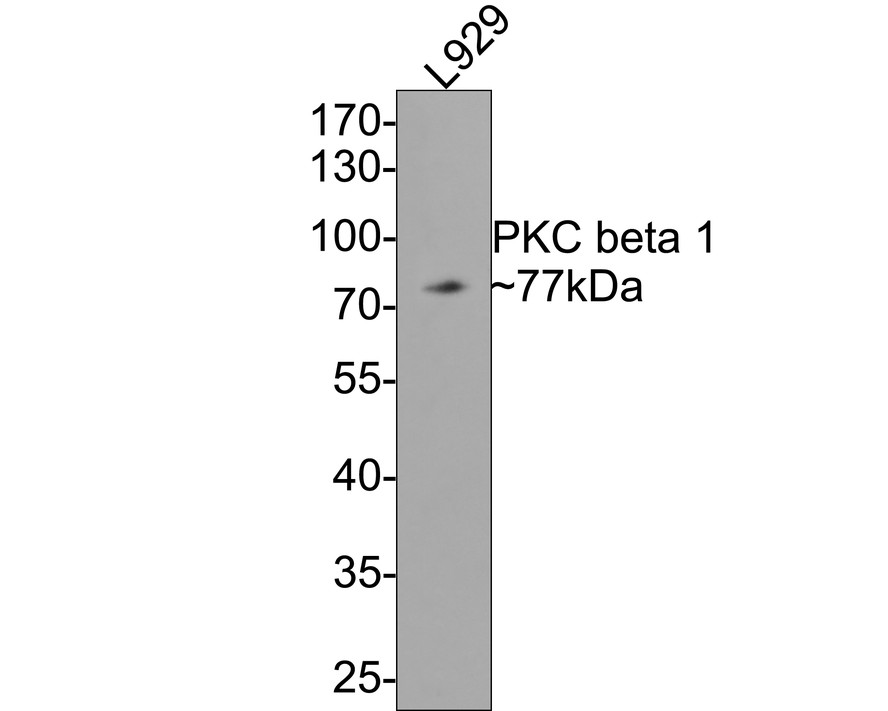 Western blot analysis of PKC beta 1 on L929 cell lysates with Rabbit anti-PKC beta 1 antibody (ET1705-30) at 1/500 dilution.<br />
<br />
Lysates/proteins at 10 µg/Lane.<br />
<br />
Predicted band size: 77 kDa<br />
Observed band size: 77 kDa<br />
<br />
Exposure time: 2 minutes;<br />
<br />
10% SDS-PAGE gel.<br />
<br />
Proteins were transferred to a PVDF membrane and blocked with 5% NFDM/TBST for 1 hour at room temperature. The primary antibody (ET1705-30) at 1/500 dilution was used in 5% NFDM/TBST at room temperature for 2 hours. Goat Anti-Rabbit IgG - HRP Secondary Antibody (HA1001) at 1:300,000 dilution was used for 1 hour at room temperature.