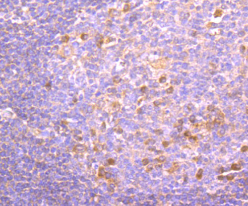 Immunohistochemical analysis of paraffin-embedded human tonsil tissue using anti-PKC beta 1 antibody. The section was pre-treated using heat mediated antigen retrieval with Tris-EDTA buffer (pH 9.0) for 20 minutes.The tissues were blocked in 1% BSA for 30 minutes at room temperature, washed with ddH2O and PBS, and then probed with the primary antibody (ET1705-30, 1/50) for 30 minutes at room temperature. The detection was performed using an HRP conjugated compact polymer system. DAB was used as the chromogen. Tissues were counterstained with hematoxylin and mounted with DPX.