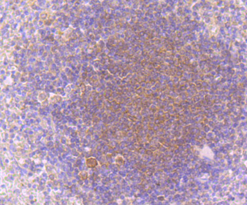 Immunohistochemical analysis of paraffin-embedded human spleen tissue using anti-PKC beta 1 antibody. The section was pre-treated using heat mediated antigen retrieval with Tris-EDTA buffer (pH 9.0) for 20 minutes.The tissues were blocked in 1% BSA for 30 minutes at room temperature, washed with ddH2O and PBS, and then probed with the primary antibody (ET1705-30, 1/50) for 30 minutes at room temperature. The detection was performed using an HRP conjugated compact polymer system. DAB was used as the chromogen. Tissues were counterstained with hematoxylin and mounted with DPX.