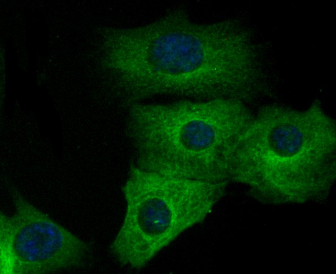 ICC staining of alpha Tubulin 4A in NIH/3T3 cells (green). Formalin fixed cells were permeabilized with 0.1% Triton X-100 in TBS for 10 minutes at room temperature and blocked with 1% Blocker BSA for 15 minutes at room temperature. Cells were probed with the primary antibody (ET1705-31, 1/50) for 1 hour at room temperature, washed with PBS. Alexa Fluor®488 Goat anti-Rabbit IgG was used as the secondary antibody at 1/1,000 dilution. The nuclear counter stain is DAPI (blue).