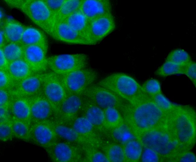 ICC staining of alpha Tubulin 4A in SW480 cells (green). Formalin fixed cells were permeabilized with 0.1% Triton X-100 in TBS for 10 minutes at room temperature and blocked with 1% Blocker BSA for 15 minutes at room temperature. Cells were probed with the primary antibody (ET1705-31, 1/50) for 1 hour at room temperature, washed with PBS. Alexa Fluor®488 Goat anti-Rabbit IgG was used as the secondary antibody at 1/1,000 dilution. The nuclear counter stain is DAPI (blue).