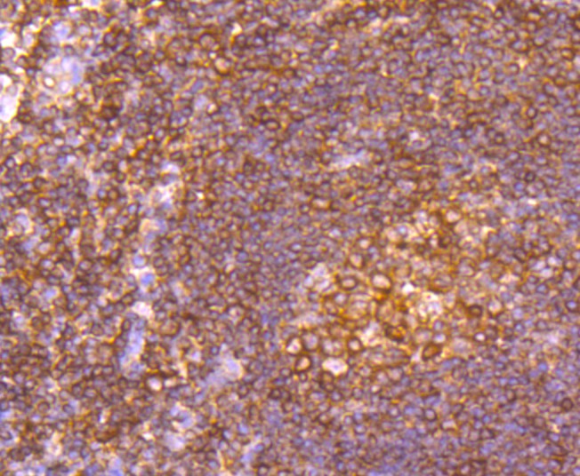 Immunohistochemical analysis of paraffin-embedded human tonsil tissue using anti-alpha Tubulin 4A antibody. The section was pre-treated using heat mediated antigen retrieval with Tris-EDTA buffer (pH 8.0-8.4) for 20 minutes.The tissues were blocked in 5% BSA for 30 minutes at room temperature, washed with ddH2O and PBS, and then probed with the primary antibody (ET1705-31, 1/50) for 30 minutes at room temperature. The detection was performed using an HRP conjugated compact polymer system. DAB was used as the chromogen. Tissues were counterstained with hematoxylin and mounted with DPX.
