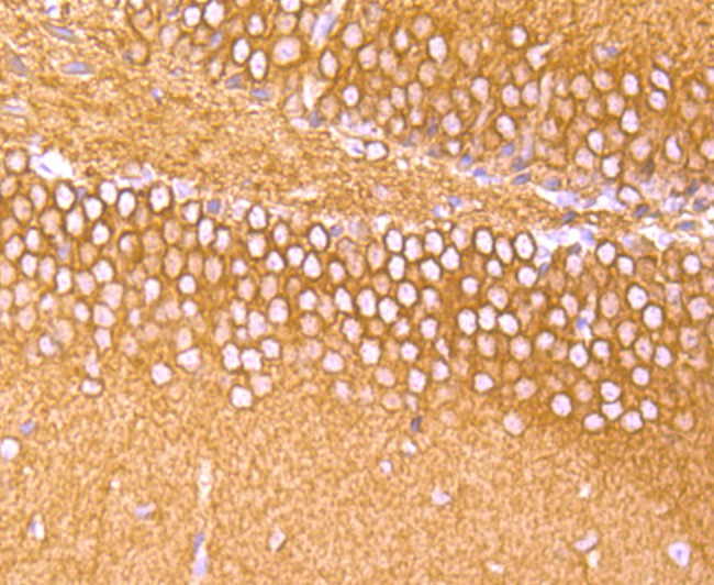 Immunohistochemical analysis of paraffin-embedded mouse brain tissue using anti-alpha Tubulin 4A antibody. The section was pre-treated using heat mediated antigen retrieval with Tris-EDTA buffer (pH 8.0-8.4) for 20 minutes.The tissues were blocked in 5% BSA for 30 minutes at room temperature, washed with ddH2O and PBS, and then probed with the primary antibody (ET1705-31, 1/50) for 30 minutes at room temperature. The detection was performed using an HRP conjugated compact polymer system. DAB was used as the chromogen. Tissues were counterstained with hematoxylin and mounted with DPX.