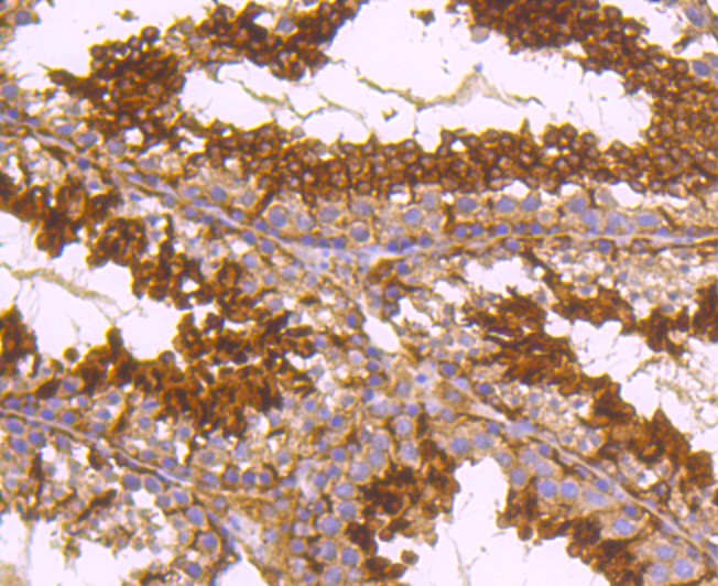 Immunohistochemical analysis of paraffin-embedded mouse testis tissue using anti-alpha Tubulin 4A antibody. The section was pre-treated using heat mediated antigen retrieval with Tris-EDTA buffer (pH 8.0-8.4) for 20 minutes.The tissues were blocked in 5% BSA for 30 minutes at room temperature, washed with ddH2O and PBS, and then probed with the primary antibody (ET1705-31, 1/50) for 30 minutes at room temperature. The detection was performed using an HRP conjugated compact polymer system. DAB was used as the chromogen. Tissues were counterstained with hematoxylin and mounted with DPX.