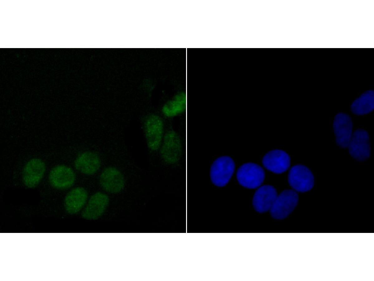 ICC staining of DDX5 in Hela cells (green). Formalin fixed cells were permeabilized with 0.1% Triton X-100 in TBS for 10 minutes at room temperature and blocked with 10% negative goat serum for 15 minutes at room temperature. Cells were probed with the primary antibody (ET1705-32, 1/50) for 1 hour at room temperature, washed with PBS. Alexa Fluor®488 conjugate-Goat anti-Rabbit IgG was used as the secondary antibody at 1/1,000 dilution. The nuclear counter stain is DAPI (blue).