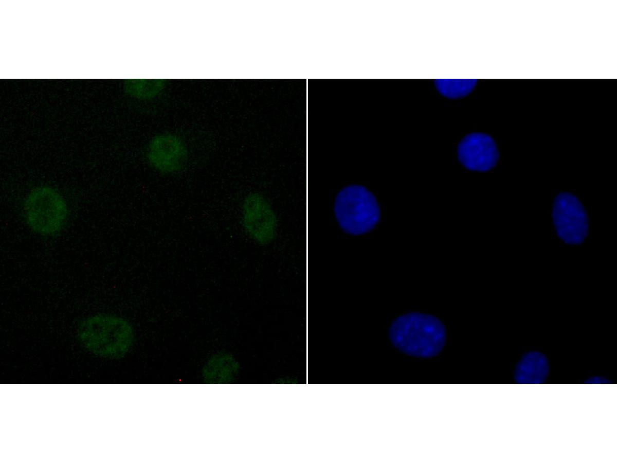 ICC staining of DDX5 in SH-SY5Y cells (green). Formalin fixed cells were permeabilized with 0.1% Triton X-100 in TBS for 10 minutes at room temperature and blocked with 10% negative goat serum for 15 minutes at room temperature. Cells were probed with the primary antibody (ET1705-32, 1/50) for 1 hour at room temperature, washed with PBS. Alexa Fluor®488 conjugate-Goat anti-Rabbit IgG was used as the secondary antibody at 1/1,000 dilution. The nuclear counter stain is DAPI (blue).