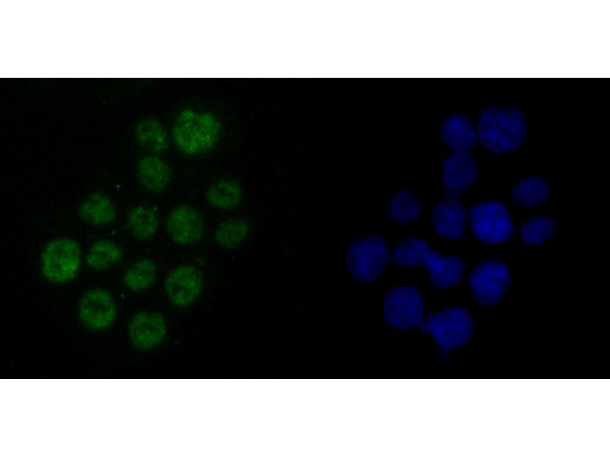 ICC staining of DDX5 in SW480 cells (green). Formalin fixed cells were permeabilized with 0.1% Triton X-100 in TBS for 10 minutes at room temperature and blocked with 10% negative goat serum for 15 minutes at room temperature. Cells were probed with the primary antibody (ET1705-32, 1/50) for 1 hour at room temperature, washed with PBS. Alexa Fluor®488 conjugate-Goat anti-Rabbit IgG was used as the secondary antibody at 1/1,000 dilution. The nuclear counter stain is DAPI (blue).