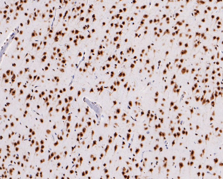 Immunohistochemical analysis of paraffin-embedded rat brain tissue with Rabbit anti-DDX5 antibody (ET1705-32) at 1/2,000 dilution.<br />
<br />
The section was pre-treated using heat mediated antigen retrieval with sodium citrate buffer (pH 6.0) for 2 minutes. The tissues were blocked in 1% BSA for 20 minutes at room temperature, washed with ddH2O and PBS, and then probed with the primary antibody (ET1705-32) at 1/2,000 dilution for 1 hour at room temperature. The detection was performed using an HRP conjugated compact polymer system. DAB was used as the chromogen. Tissues were counterstained with hematoxylin and mounted with DPX.