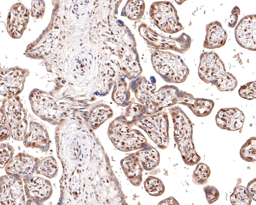 Immunohistochemical analysis of paraffin-embedded human placenta tissue with Rabbit anti-DDX5 antibody (ET1705-32) at 1/100 dilution.<br />
<br />
The section was pre-treated using heat mediated antigen retrieval with sodium citrate buffer (pH 6.0) for 2 minutes. The tissues were blocked in 1% BSA for 20 minutes at room temperature, washed with ddH2O and PBS, and then probed with the primary antibody (ET1705-32) at 1/100 dilution for 1 hour at room temperature. The detection was performed using an HRP conjugated compact polymer system. DAB was used as the chromogen. Tissues were counterstained with hematoxylin and mounted with DPX.