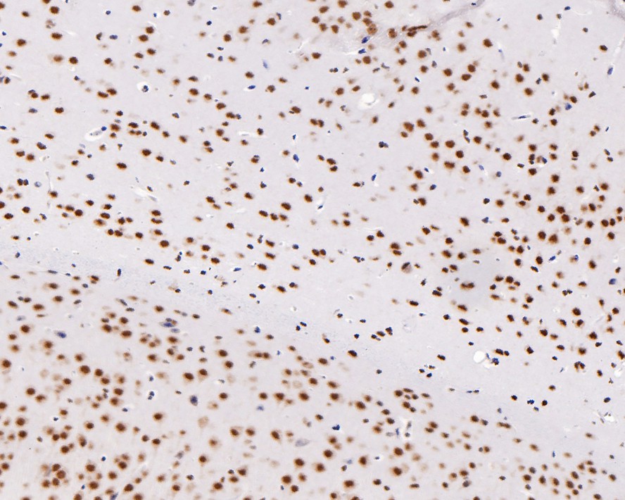 Immunohistochemical analysis of paraffin-embedded mouse brain tissue with Rabbit anti-DDX5 antibody (ET1705-32) at 1/400 dilution.<br />
<br />
The section was pre-treated using heat mediated antigen retrieval with sodium citrate buffer (pH 6.0) for 2 minutes. The tissues were blocked in 1% BSA for 20 minutes at room temperature, washed with ddH2O and PBS, and then probed with the primary antibody (ET1705-32) at 1/400 dilution for 1 hour at room temperature. The detection was performed using an HRP conjugated compact polymer system. DAB was used as the chromogen. Tissues were counterstained with hematoxylin and mounted with DPX.