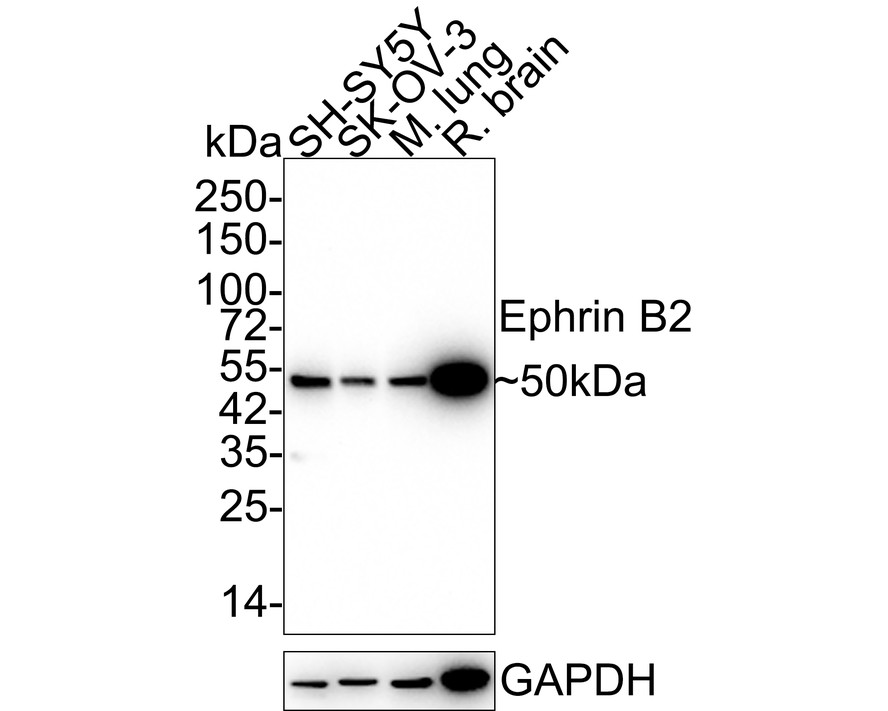 Western blot analysis of Ephrin B2 on different lysates with Rabbit anti-Ephrin B2 antibody (ET1705-33) at 1/500 dilution.<br />
<br />
Lane 1: A431 cell lysate (10 µg/Lane)<br />
Lane 2: Human kidney tissue lysate (20 µg/Lane)<br />
Lane 3: Mouse lung tissue lysate (20 µg/Lane)<br />
Lane 4: Rat brain tissue lysate (20 µg/Lane)<br />
<br />
Predicted band size: 37 kDa<br />
Observed band size: 50 kDa<br />
<br />
Exposure time: 1 minute;<br />
<br />
10% SDS-PAGE gel.<br />
<br />
Proteins were transferred to a PVDF membrane and blocked with 5% NFDM/TBST for 1 hour at room temperature. The primary antibody (ET1705-33) at 1/500 dilution was used in 5% NFDM/TBST at room temperature for 2 hours. Goat Anti-Rabbit IgG - HRP Secondary Antibody (HA1001) at 1:300,000 dilution was used for 1 hour at room temperature.