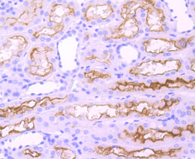 Immunohistochemical analysis of paraffin-embedded human kidney tissue using anti-ACE antibody. The section was pre-treated using heat mediated antigen retrieval with Tris-EDTA buffer (pH 9.0) for 20 minutes.The tissues were blocked in 5% BSA for 30 minutes at room temperature, washed with ddH2O and PBS, and then probed with the primary antibody (ET1705-36, 1/50) for 30 minutes at room temperature. The detection was performed using an HRP conjugated compact polymer system. DAB was used as the chromogen. Tissues were counterstained with hematoxylin and mounted with DPX.