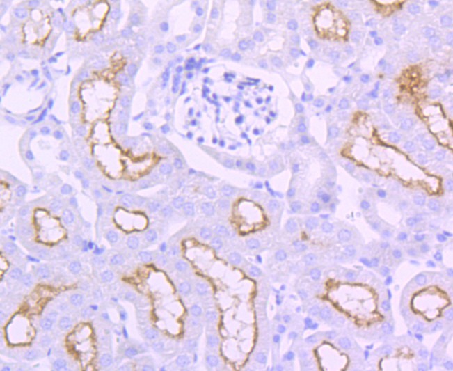 Immunohistochemical analysis of paraffin-embedded mouse kidney tissue using anti-ACE antibody. The section was pre-treated using heat mediated antigen retrieval with Tris-EDTA buffer (pH 9.0) for 20 minutes.The tissues were blocked in 5% BSA for 30 minutes at room temperature, washed with ddH2O and PBS, and then probed with the primary antibody (ET1705-36, 1/50) for 30 minutes at room temperature. The detection was performed using an HRP conjugated compact polymer system. DAB was used as the chromogen. Tissues were counterstained with hematoxylin and mounted with DPX.
