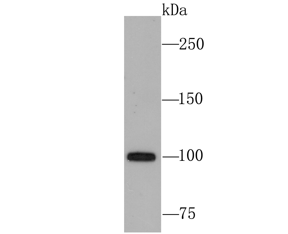 Western blot analysis of USP11 on 293T cell lysates. Proteins were transferred to a PVDF membrane and blocked with 5% BSA in PBS for 1 hour at room temperature. The primary antibody (ET1705-38, 1/500) was used in 5% BSA at room temperature for 2 hours. Goat Anti-Rabbit IgG - HRP Secondary Antibody (HA1001) at 1:200,000 dilution was used for 1 hour at room temperature.