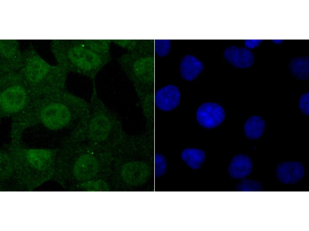 ICC staining of USP11 in A549 cells (green). Formalin fixed cells were permeabilized with 0.1% Triton X-100 in TBS for 10 minutes at room temperature and blocked with 10% negative goat serum for 15 minutes at room temperature. Cells were probed with the primary antibody (ET1705-38, 1/50) for 1 hour at room temperature, washed with PBS. Alexa Fluor®488 conjugate-Goat anti-Rabbit IgG was used as the secondary antibody at 1/1,000 dilution. The nuclear counter stain is DAPI (blue).