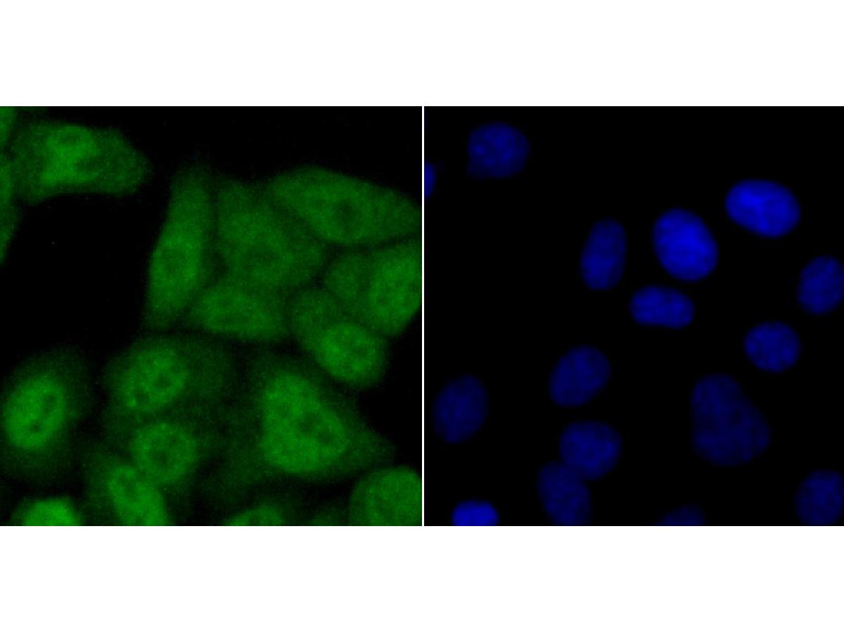 ICC staining of USP11 in HepG2 cells (green). Formalin fixed cells were permeabilized with 0.1% Triton X-100 in TBS for 10 minutes at room temperature and blocked with 10% negative goat serum for 15 minutes at room temperature. Cells were probed with the primary antibody (ET1705-38, 1/50) for 1 hour at room temperature, washed with PBS. Alexa Fluor®488 conjugate-Goat anti-Rabbit IgG was used as the secondary antibody at 1/1,000 dilution. The nuclear counter stain is DAPI (blue).