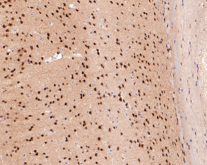 Immunohistochemical analysis of paraffin-embedded mouse brain tissue using anti-USP11 antibody. The section was pre-treated using heat mediated antigen retrieval with sodium citrate buffer (pH 6.0) for 20 minutes. The tissues were blocked in 1% BSA for 30 minutes at room temperature, washed with ddH2O and PBS, and then probed with the primary antibody (ET1705-38, 1/400)  for 30 minutes at room temperature. The detection was performed using an HRP conjugated compact polymer system. DAB was used as the chromogen. Tissues were counterstained with hematoxylin and mounted with DPX.