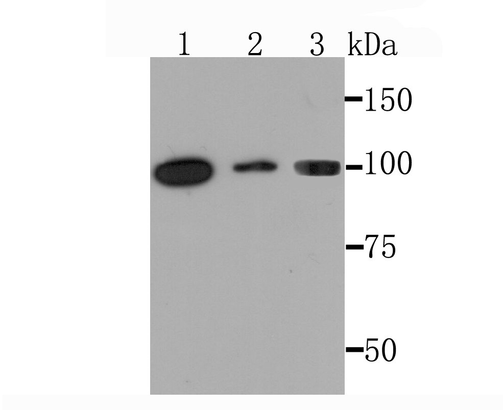 Western blot analysis of PKC mu on different lysates. Proteins were transferred to a PVDF membrane and blocked with 5% BSA in PBS for 1 hour at room temperature. The primary antibody (ET1705-4, 1/500) was used in 5% BSA at room temperature for 2 hours. Goat Anti-Rabbit IgG - HRP Secondary Antibody (HA1001) at 1:200,000 dilution was used for 1 hour at room temperature.<br />
Positive control: <br />
Lane 1: Hela cell lysate<br />
Lane 2: Mouse kidney tissue lysate<br />
Lane 3: PC-12 cell lysate