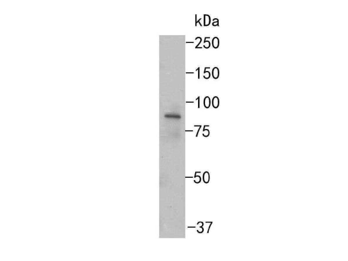 Western blot analysis of PKC mu on PC-3 cell lysates. Proteins were transferred to a PVDF membrane and blocked with 5% BSA in PBS for 1 hour at room temperature. The primary antibody (ET1705-4, 1/500) was used in 5% BSA at room temperature for 2 hours. Goat Anti-Rabbit IgG - HRP Secondary Antibody (HA1001) at 1:200,000 dilution was used for 1 hour at room temperature.
