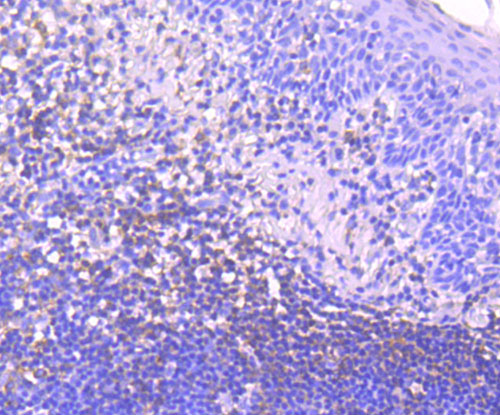 Immunohistochemical analysis of paraffin-embedded human tonsil tissue using anti-IKB epsilon antibody. The section was pre-treated using heat mediated antigen retrieval with Tris-EDTA buffer (pH 9.0) for 20 minutes.The tissues were blocked in 1% BSA for 30 minutes at room temperature, washed with ddH2O and PBS, and then probed with the primary antibody (ET1705-40, 1/50) for 30 minutes at room temperature. The detection was performed using an HRP conjugated compact polymer system. DAB was used as the chromogen. Tissues were counterstained with hematoxylin and mounted with DPX.