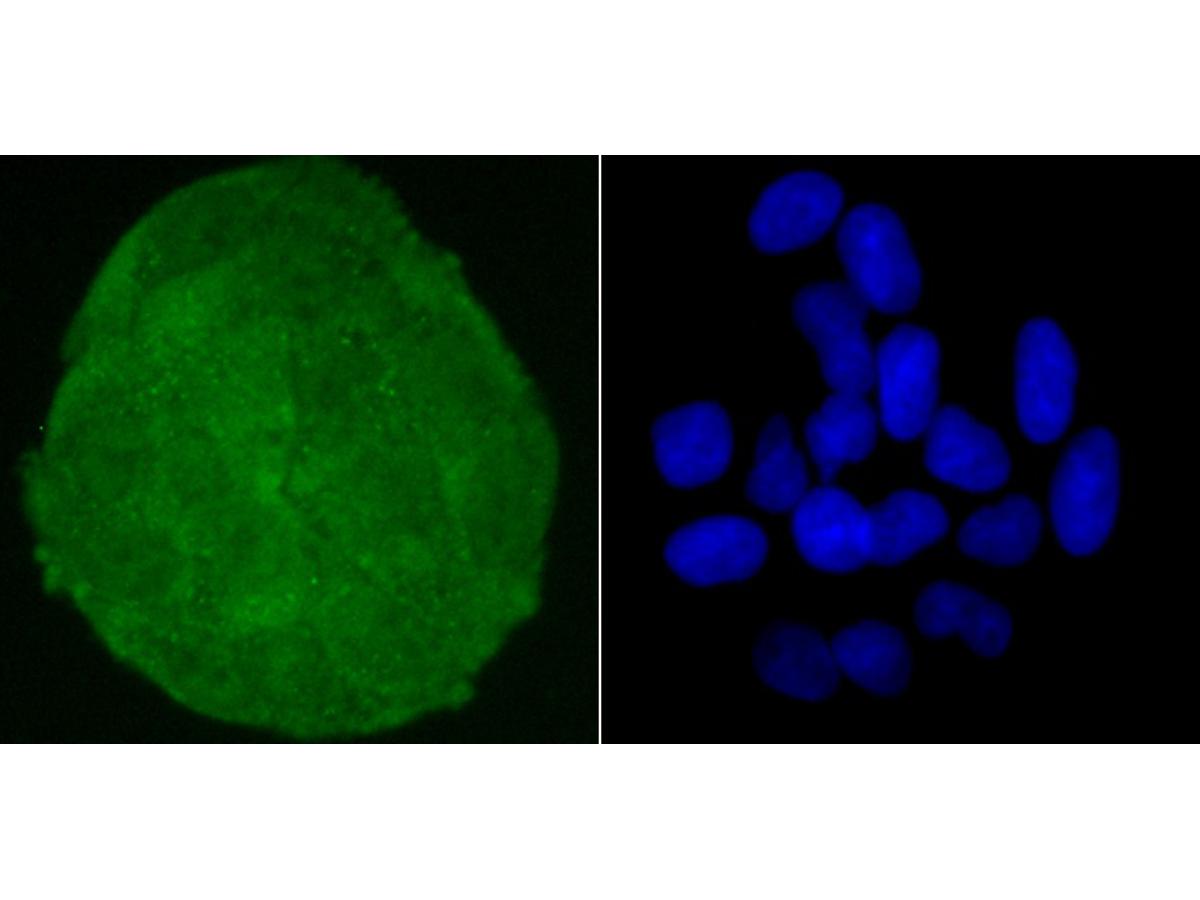 ICC staining of Skp1 in Hela cells (green). Formalin fixed cells were permeabilized with 0.1% Triton X-100 in TBS for 10 minutes at room temperature and blocked with 1% Blocker BSA for 15 minutes at room temperature. Cells were probed with the primary antibody (ET1705-43, 1/50) for 1 hour at room temperature, washed with PBS. Alexa Fluor®488 Goat anti-Rabbit IgG was used as the secondary antibody at 1/1,000 dilution. The nuclear counter stain is DAPI (blue).