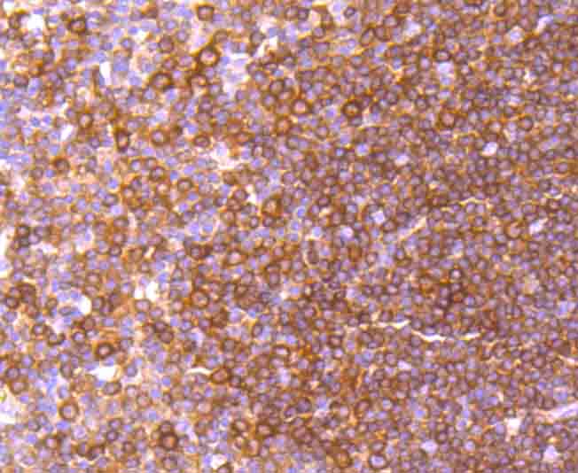 Immunohistochemical analysis of paraffin-embedded human tonsil tissue using anti-c-Rel antibody. Counter stained with hematoxylin.
