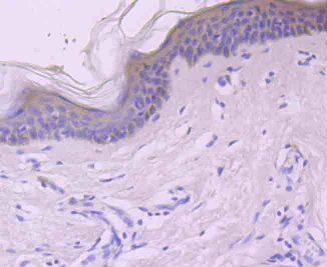 Immunohistochemical analysis of paraffin-embedded human skin tissue using anti-c-Rel antibody. Counter stained with hematoxylin.