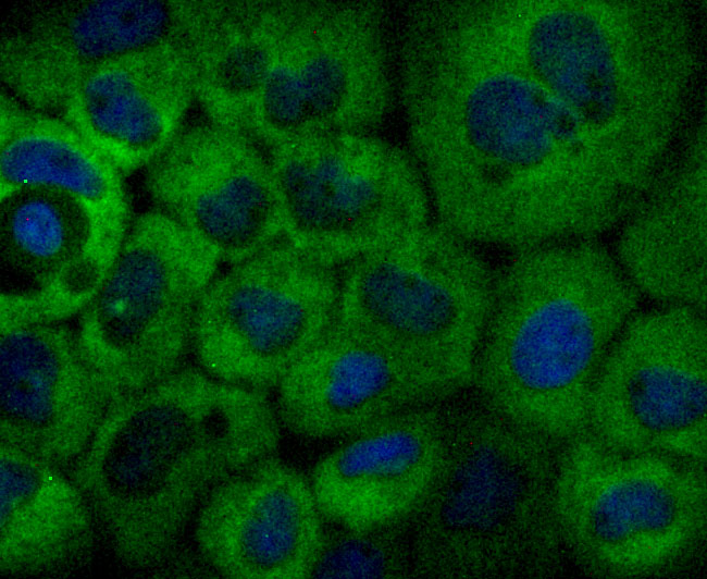 ICC staining of NFkB p100 in A431 cells (green). Formalin fixed cells were permeabilized with 0.1% Triton X-100 in TBS for 10 minutes at room temperature and blocked with 1% Blocker BSA for 15 minutes at room temperature. Cells were probed with the primary antibody (ET1705-45, 1/50) for 1 hour at room temperature, washed with PBS. Alexa Fluor®488 Goat anti-Rabbit IgG was used as the secondary antibody at 1/1,000 dilution. The nuclear counter stain is DAPI (blue).