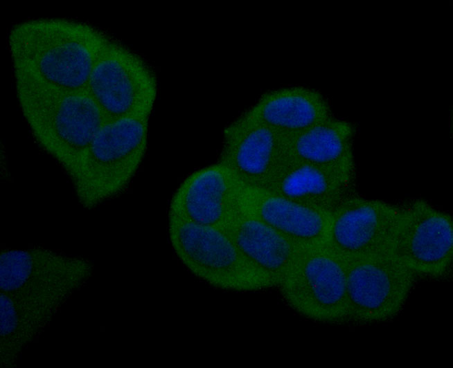 ICC staining of NFkB p100 in Hela cells (green). Formalin fixed cells were permeabilized with 0.1% Triton X-100 in TBS for 10 minutes at room temperature and blocked with 1% Blocker BSA for 15 minutes at room temperature. Cells were probed with the primary antibody (ET1705-45, 1/50) for 1 hour at room temperature, washed with PBS. Alexa Fluor®488 Goat anti-Rabbit IgG was used as the secondary antibody at 1/1,000 dilution. The nuclear counter stain is DAPI (blue).