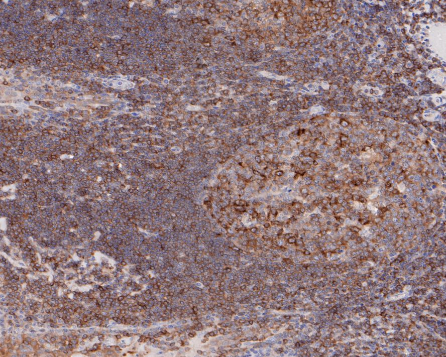 Immunohistochemical analysis of paraffin-embedded human tonsil tissue with Rabbit anti-NFkB p100 antibody (ET1705-45) at 1/200 dilution.<br />
<br />
The section was pre-treated using heat mediated antigen retrieval with sodium citrate buffer (pH 6.0) for 2 minutes. The tissues were blocked in 1% BSA for 20 minutes at room temperature, washed with ddH2O and PBS, and then probed with the primary antibody (ET1705-45) at 1/200 dilution for 1 hour at room temperature. The detection was performed using an HRP conjugated compact polymer system. DAB was used as the chromogen. Tissues were counterstained with hematoxylin and mounted with DPX.
