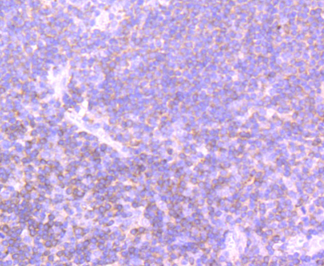 Immunohistochemical analysis of paraffin-embedded human tonsil tissue using anti-PI 3 Kinase p110 delta antibody. The section was pre-treated using heat mediated antigen retrieval with Tris-EDTA buffer (pH 8.0-8.4) for 20 minutes.The tissues were blocked in 5% BSA for 30 minutes at room temperature, washed with ddH2O and PBS, and then probed with the primary antibody (ET1705-46, 1/50) for 30 minutes at room temperature. The detection was performed using an HRP conjugated compact polymer system. DAB was used as the chromogen. Tissues were counterstained with hematoxylin and mounted with DPX.