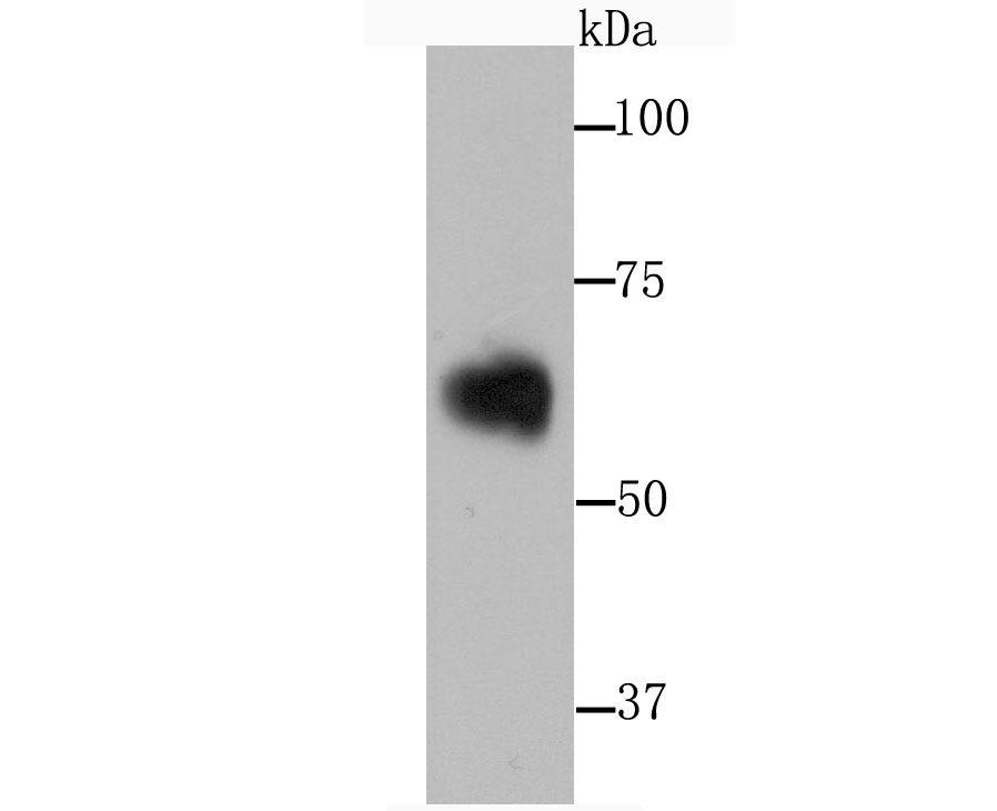 Western blot analysis of alpha 1 Antichymotrypsin on human serum using anti-alpha 1 Antichymotrypsin antibody at 1/1,000 dilution.