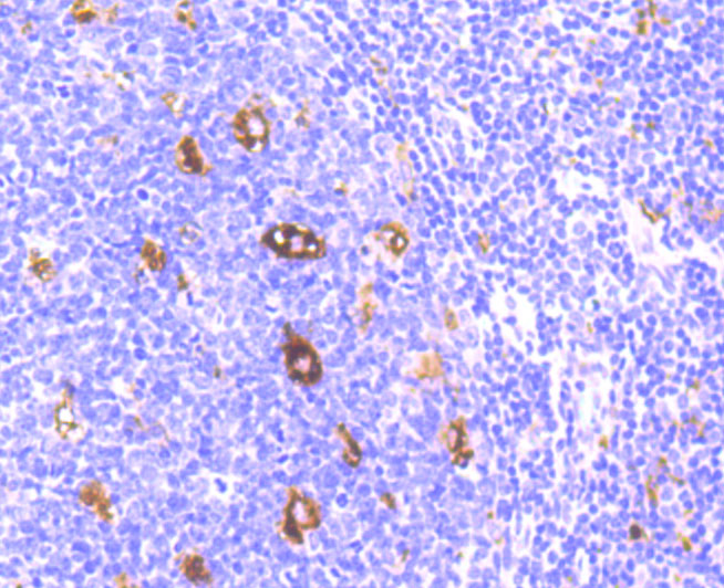 Immunohistochemical analysis of paraffin-embedded human tonsil tissue using anti-alpha 1 Antichymotrypsin antibody. Counter stained with hematoxylin.