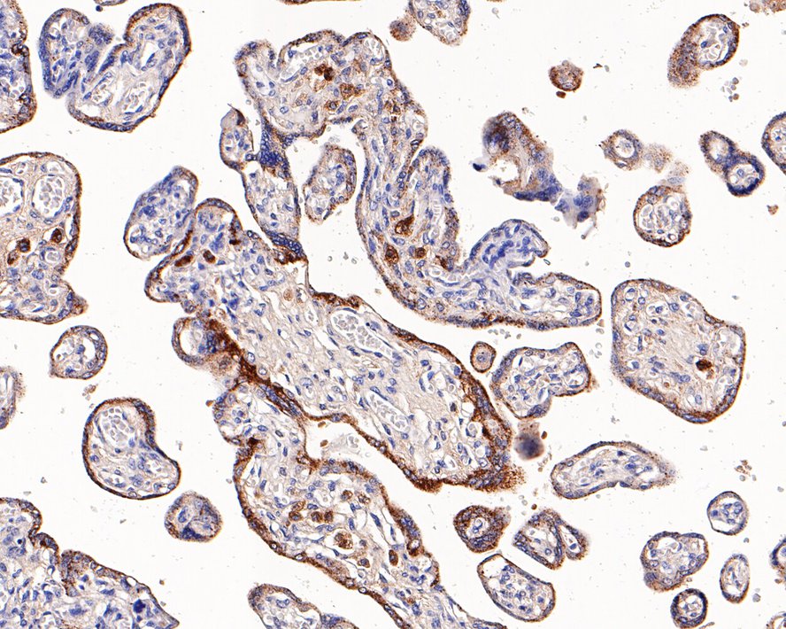 Immunohistochemical analysis of paraffin-embedded human placenta tissue using anti-alpha 1 Antichymotrypsin antibody. Counter stained with hematoxylin.