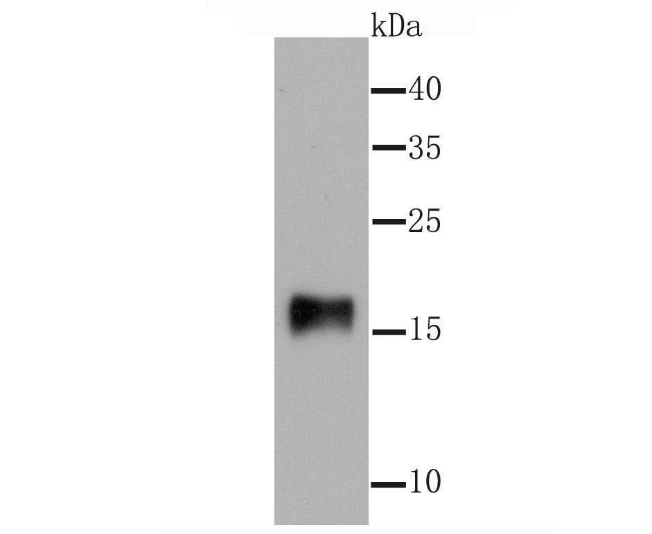 Western blot analysis of gamma Synuclein on rat kidney tissue lysates. Proteins were transferred to a PVDF membrane and blocked with 5% BSA in PBS for 1 hour at room temperature. The primary antibody (ET1705-48, 1/500) was used in 5% BSA at room temperature for 2 hours. Goat Anti-Rabbit IgG - HRP Secondary Antibody (HA1001) at 1:200,000 dilution was used for 1 hour at room temperature.