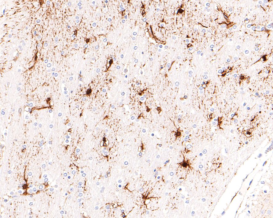 Immunohistochemical analysis of paraffin-embedded rat brain tissue with Rabbit anti-gamma Synuclein antibody (ET1705-48) at 1/400 dilution.<br />
<br />
The section was pre-treated using heat mediated antigen retrieval with Tris-EDTA buffer (pH 9.0) for 20 minutes. The tissues were blocked in 1% BSA for 20 minutes at room temperature, washed with ddH2O and PBS, and then probed with the primary antibody (ET1705-48) at 1/400 dilution for 1 hour at room temperature. The detection was performed using an HRP conjugated compact polymer system. DAB was used as the chromogen. Tissues were counterstained with hematoxylin and mounted with DPX.