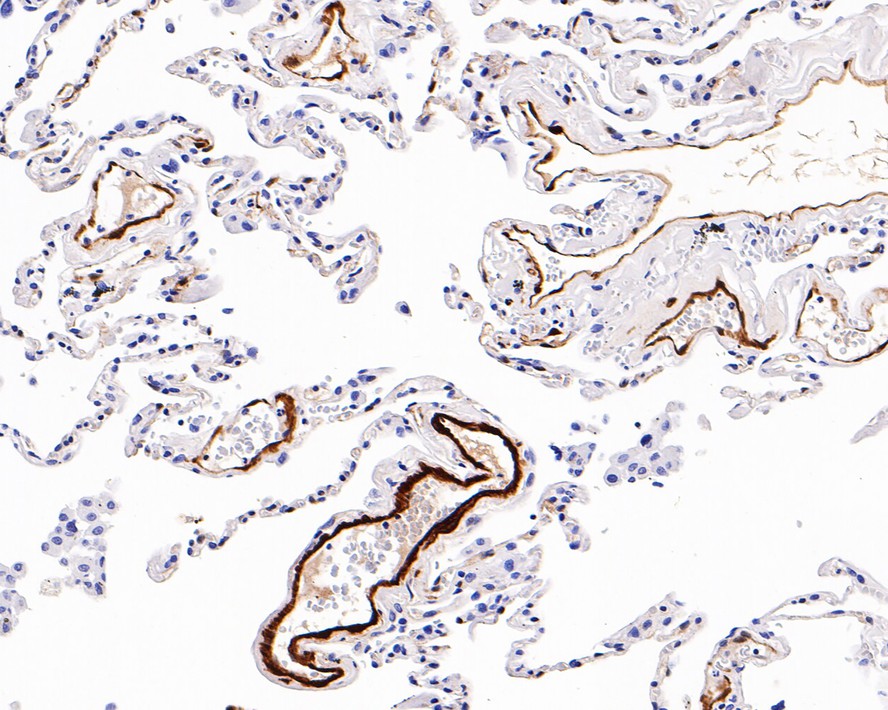 Immunohistochemical analysis of paraffin-embedded human lung tissue with Rabbit anti-gamma Synuclein antibody (ET1705-48) at 1/1,000 dilution.<br />
<br />
The section was pre-treated using heat mediated antigen retrieval with Tris-EDTA buffer (pH 9.0) for 20 minutes. The tissues were blocked in 1% BSA for 20 minutes at room temperature, washed with ddH2O and PBS, and then probed with the primary antibody (ET1705-48) at 1/1,000 dilution for 1 hour at room temperature. The detection was performed using an HRP conjugated compact polymer system. DAB was used as the chromogen. Tissues were counterstained with hematoxylin and mounted with DPX.