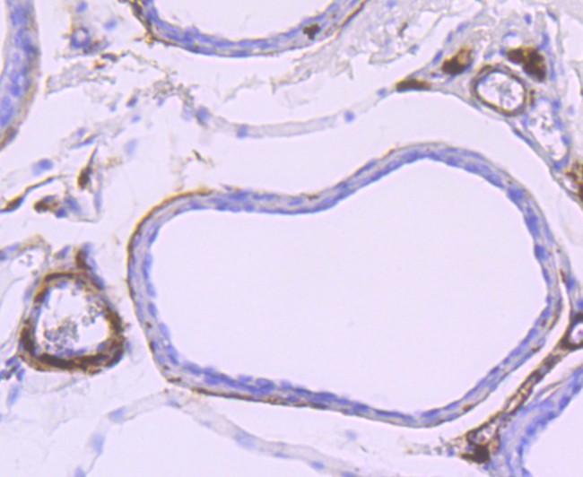 Immunohistochemical analysis of paraffin-embedded rat bladder tissue using anti-gamma Synuclein antibody. The section was pre-treated using heat mediated antigen retrieval with Tris-EDTA buffer (pH 9.0) for 20 minutes.The tissues were blocked in 1% BSA for 30 minutes at room temperature, washed with ddH2O and PBS, and then probed with the primary antibody (ET1705-48, 1/50) for 30 minutes at room temperature. The detection was performed using an HRP conjugated compact polymer system. DAB was used as the chromogen. Tissues were counterstained with hematoxylin and mounted with DPX.