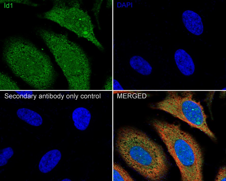 ICC staining Id1 in Hela cells (green). The nuclear counter stain is DAPI (blue). Cells were fixed in paraformaldehyde, permeabilised with 0.25% Triton X100/PBS.