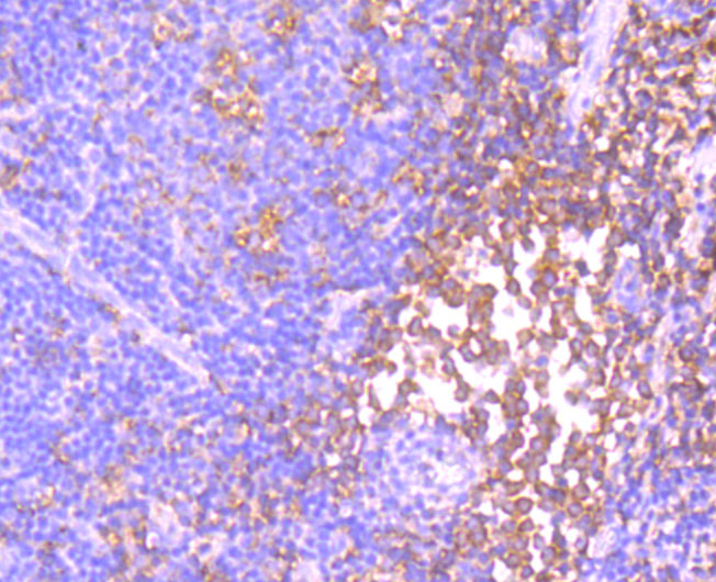 Immunohistochemical analysis of paraffin-embedded human tonsil tissue using anti-Id1 antibody. Counter stained with hematoxylin.