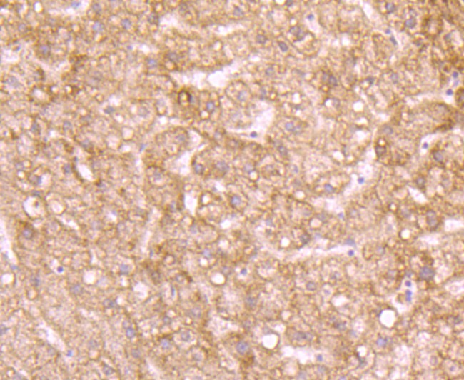 Immunohistochemical analysis of paraffin-embedded human liver tissue using anti-Id1 antibody. Counter stained with hematoxylin.