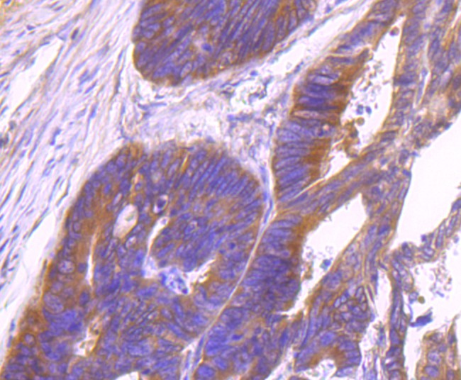 Immunohistochemical analysis of paraffin-embedded human colon tissue using anti-Id1 antibody. Counter stained with hematoxylin.