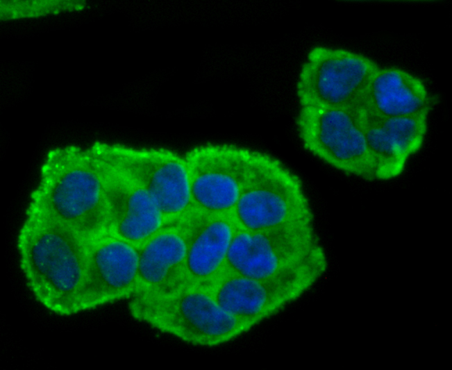 ICC staining of BMAL1 in Hela cells (green). Formalin fixed cells were permeabilized with 0.1% Triton X-100 in TBS for 10 minutes at room temperature and blocked with 1% Blocker BSA for 15 minutes at room temperature. Cells were probed with the primary antibody (ET1705-5, 1/50) for 1 hour at room temperature, washed with PBS. Alexa Fluor®488 Goat anti-Rabbit IgG was used as the secondary antibody at 1/1,000 dilution. The nuclear counter stain is DAPI (blue).