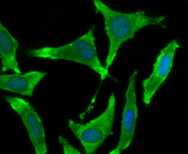 ICC staining of BMAL1 in SH-SY5Y cells (green). Formalin fixed cells were permeabilized with 0.1% Triton X-100 in TBS for 10 minutes at room temperature and blocked with 1% Blocker BSA for 15 minutes at room temperature. Cells were probed with the primary antibody (ET1705-5, 1/50) for 1 hour at room temperature, washed with PBS. Alexa Fluor®488 Goat anti-Rabbit IgG was used as the secondary antibody at 1/1,000 dilution. The nuclear counter stain is DAPI (blue).