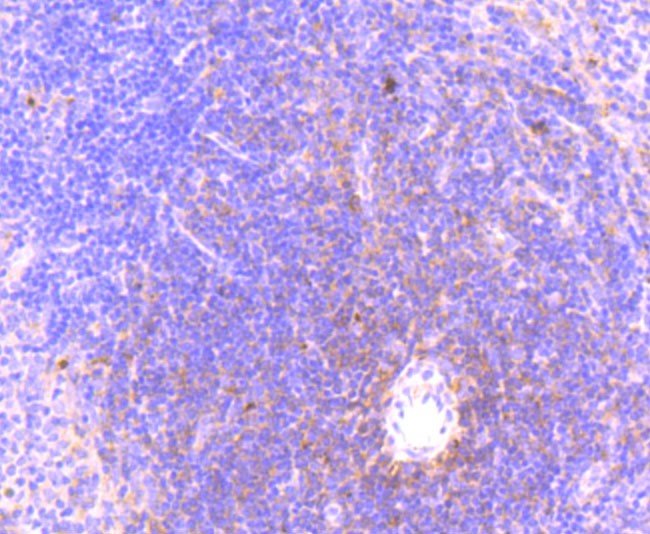 Immunohistochemical analysis of paraffin-embedded mouse lung tissue using anti-MLKL (phospho S345) antibody. The section was pre-treated using heat mediated antigen retrieval with Tris-EDTA buffer (pH 9.0) for 20 minutes.The tissues were blocked in 5% BSA for 30 minutes at room temperature, washed with ddH2O and PBS, and then probed with the primary antibody (ET1705-51, 1/50) for 30 minutes at room temperature. The detection was performed using an HRP conjugated compact polymer system. DAB was used as the chromogen. Tissues were counterstained with hematoxylin and mounted with DPX.